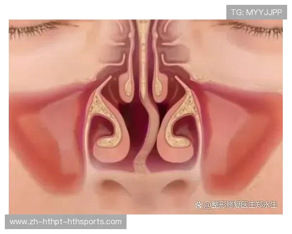 鼻炎患者冬泳是否安全?医学建议与禁忌解析